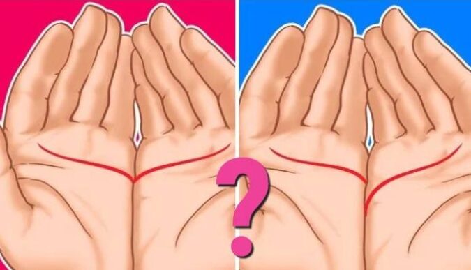 Что означает линия сердца на руке?